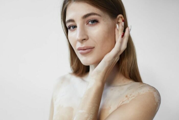 ACM VITICOLOR GEL CORRECTEUR DE TEINT - 50 ML – Image 2
