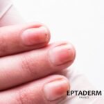 EPTADERM EPTA PSO ONGLES SOLUTION - 12 ML – Image 2