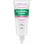 SOMATOLINE CORRECTION VERGETURES SÉRUM RÉPARATEUR - 100 ML